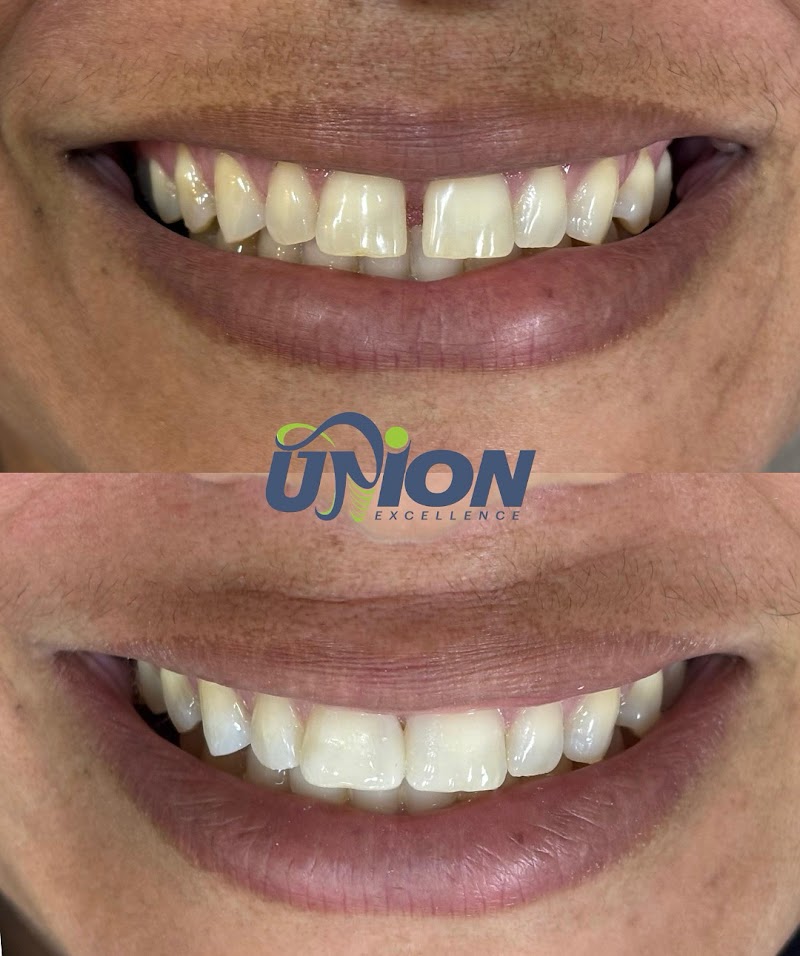 Union Odontologia - Implante e Prótese Dentária em Resende/RJ - foto 4