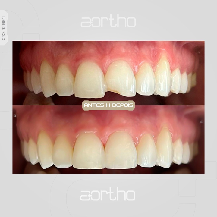 Dr. Aldir Cordeiro | Invisalign em Petrópolis - foto 4