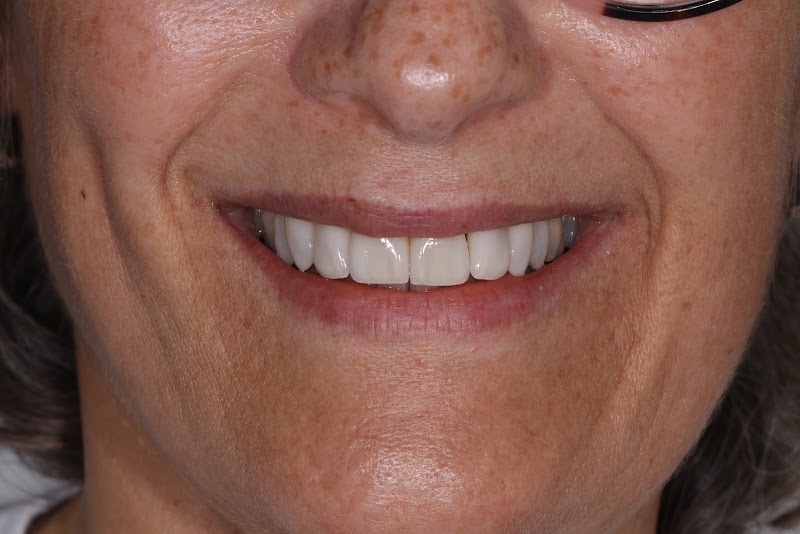 Dr. Miguel Angelo Nogueira – Cirurgião Dentista Implantodontista - Petropolis RJ - foto 4