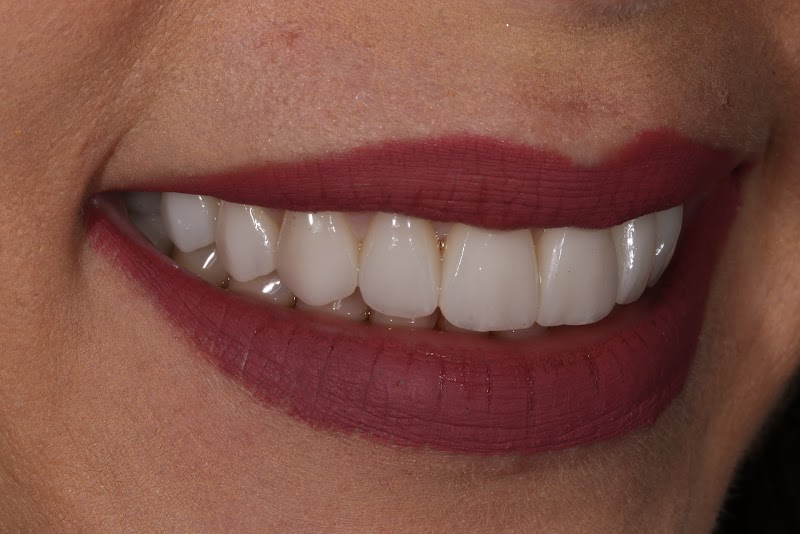 Dr. Miguel Angelo Nogueira – Cirurgião Dentista Implantodontista - Petropolis RJ