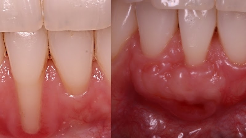 Dr. Miguel Angelo Nogueira – Cirurgião Dentista Implantodontista - Petropolis RJ - foto 3