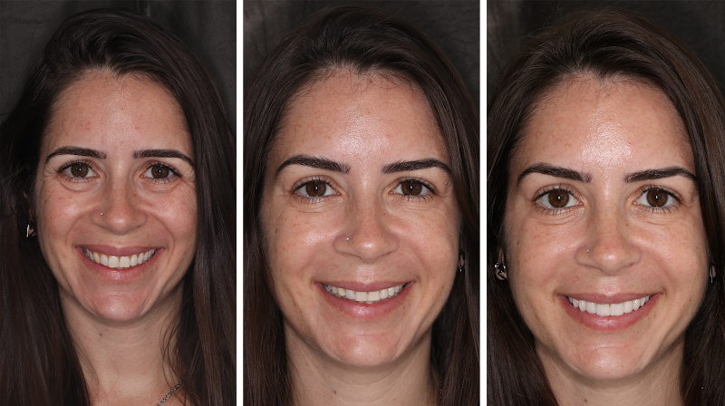 Dr. Miguel Angelo Nogueira – Cirurgião Dentista Implantodontista - Petropolis RJ - foto 5