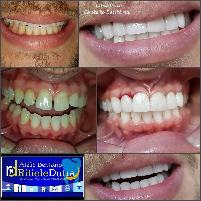 Dentista Drª Ritiele Lourdes- implantes dentários- Clínica Odontológica Hottz Dental Clinc - Nova Friburgo - foto 2