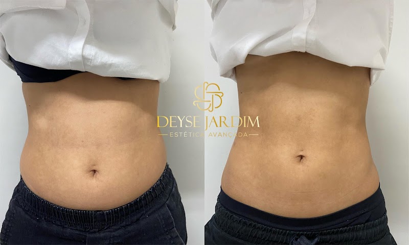 Dra. Deyse Jardim - Clínica de Estética e Odontologia na Savassi em BH - foto 5