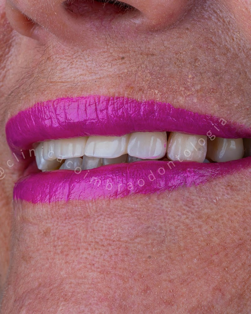 Implantes Dentários | Dentista | Clínica Coimbra Odontologia | Nova Iguaçu RJ - foto 5