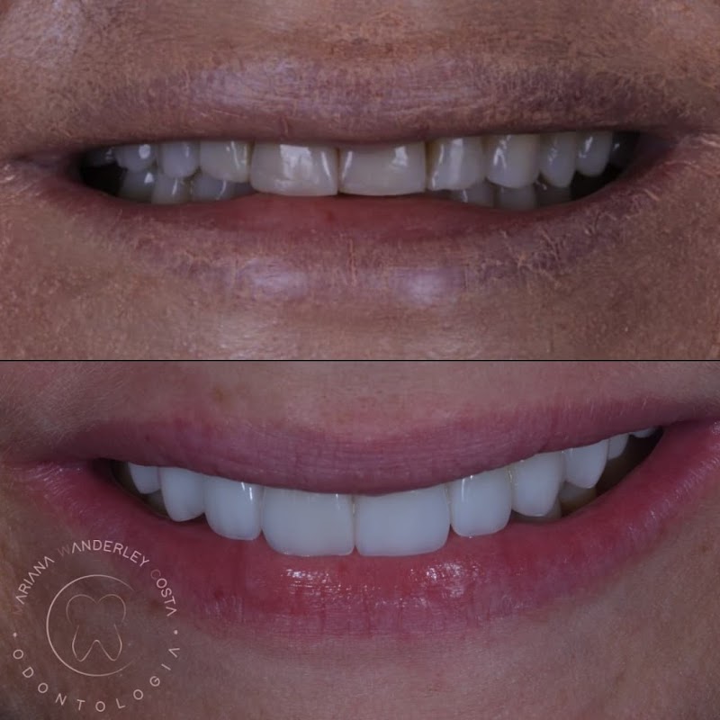 Drª Mariana Wanderley Costa - Cirurgiã-dentista - foto 2