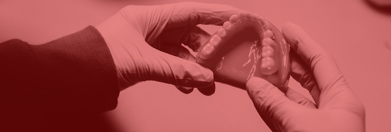 Laboratório de Prótese Flores | Prótese Dentária Total Removível