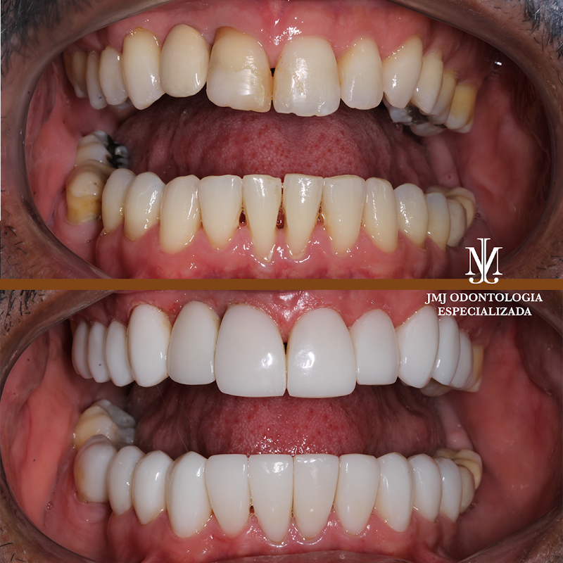 Consultório da Vila - Unid. 3 | Implante Dentário - foto 4