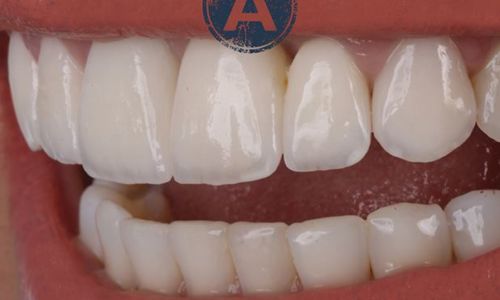 Ateliê Oral | Clínica Odontológica Especializada em Reabilitação Oral no Itaim Bibi Zona Sul SP - foto 2