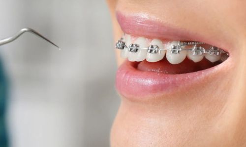 Ateliê Oral | Clínica Odontológica Especializada em Reabilitação Oral no Itaim Bibi Zona Sul SP - foto 4