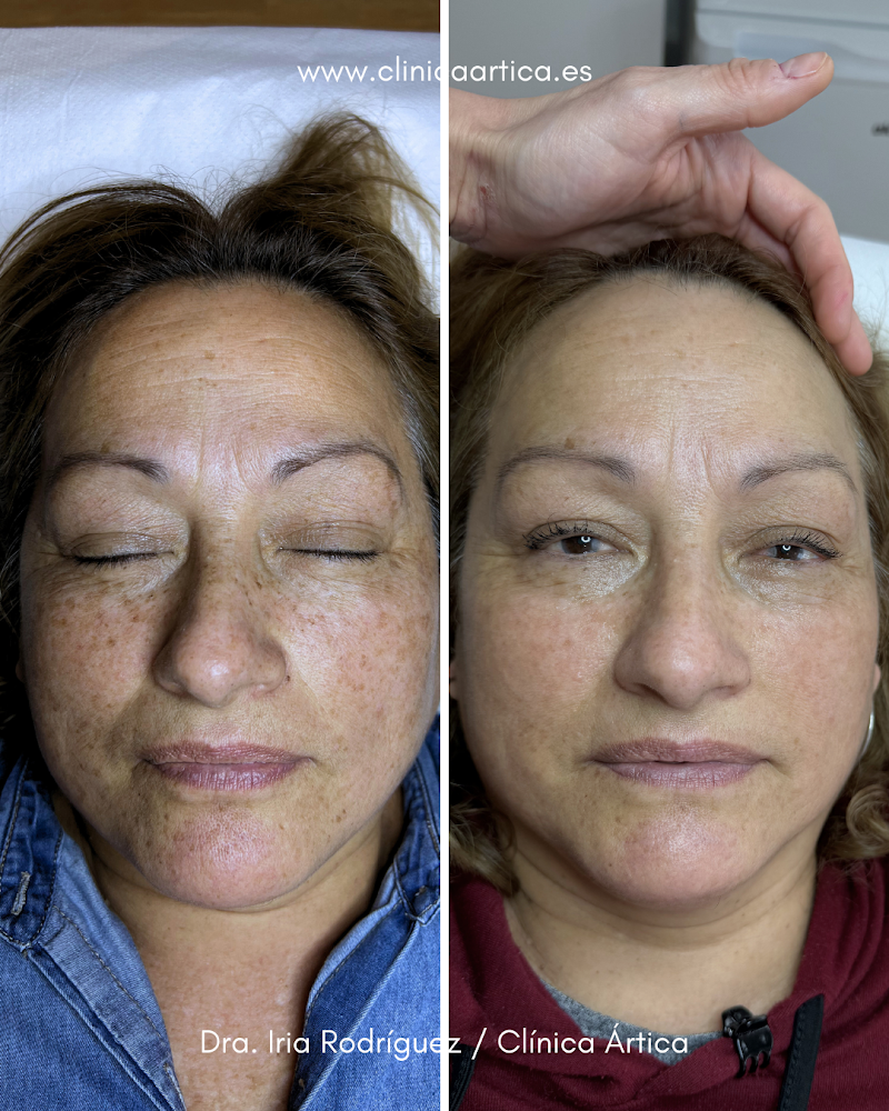 Ártica | Clínica Medicina Estética Viveiro - Lugo photo 5