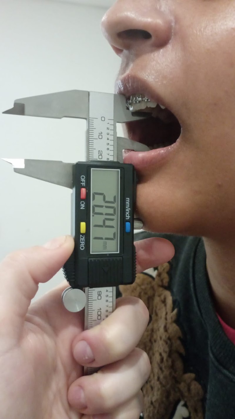 Foto de Thaline Antunes - fisioterapia bucomaxilofacial, cabeça e pescoço