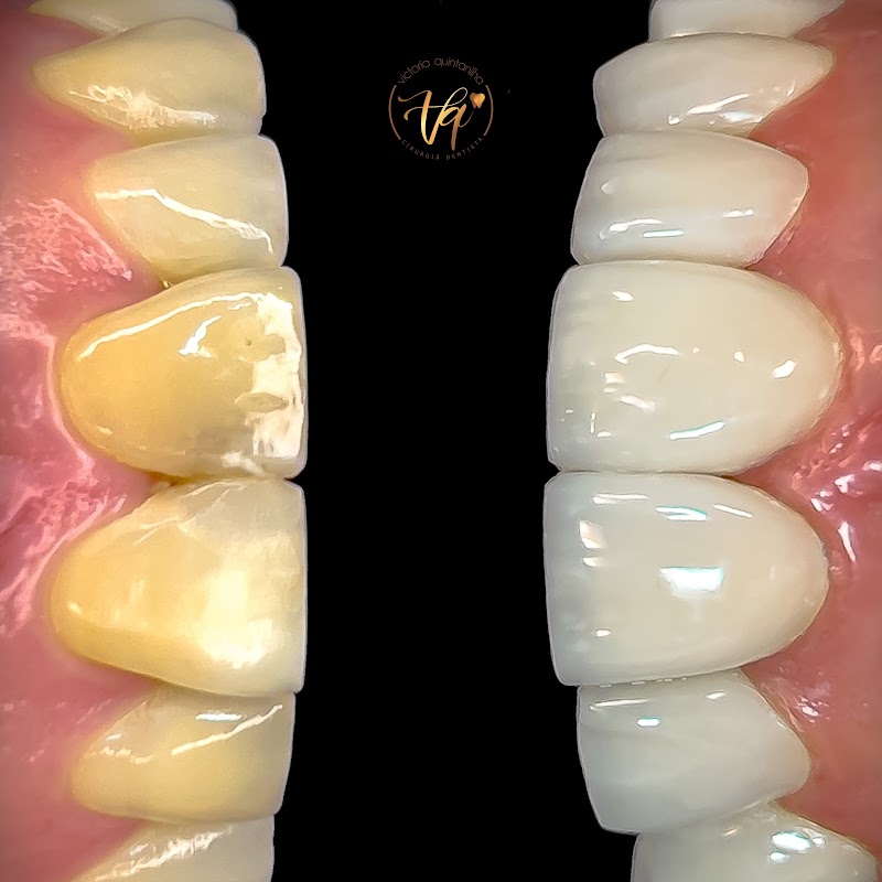 Dra. Victoria Quintanilha l Dentista São Gonçalo - foto 5