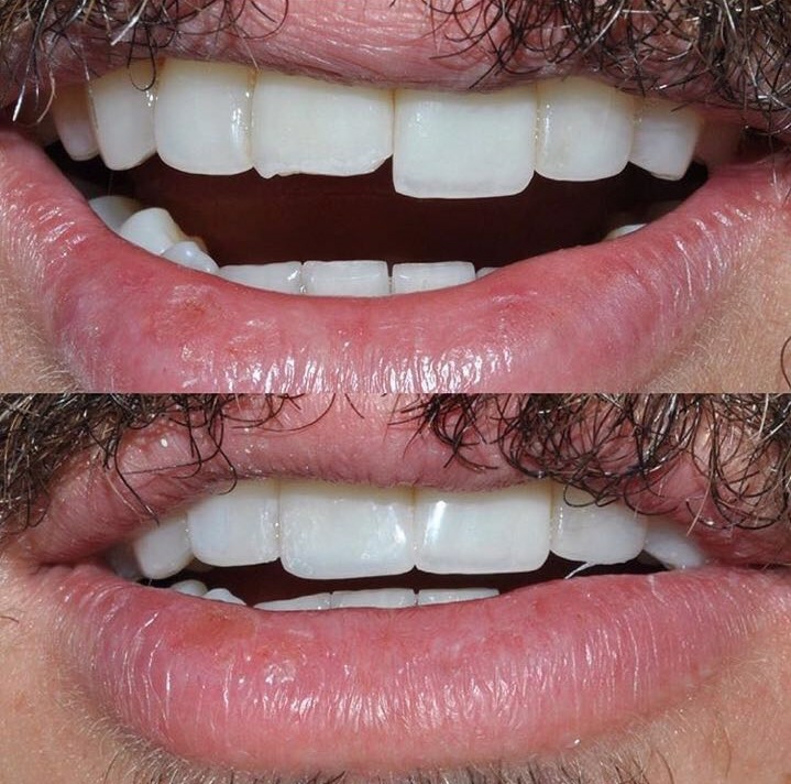 MG Odontologia clinica e Estética - dentista Manaus - foto 4