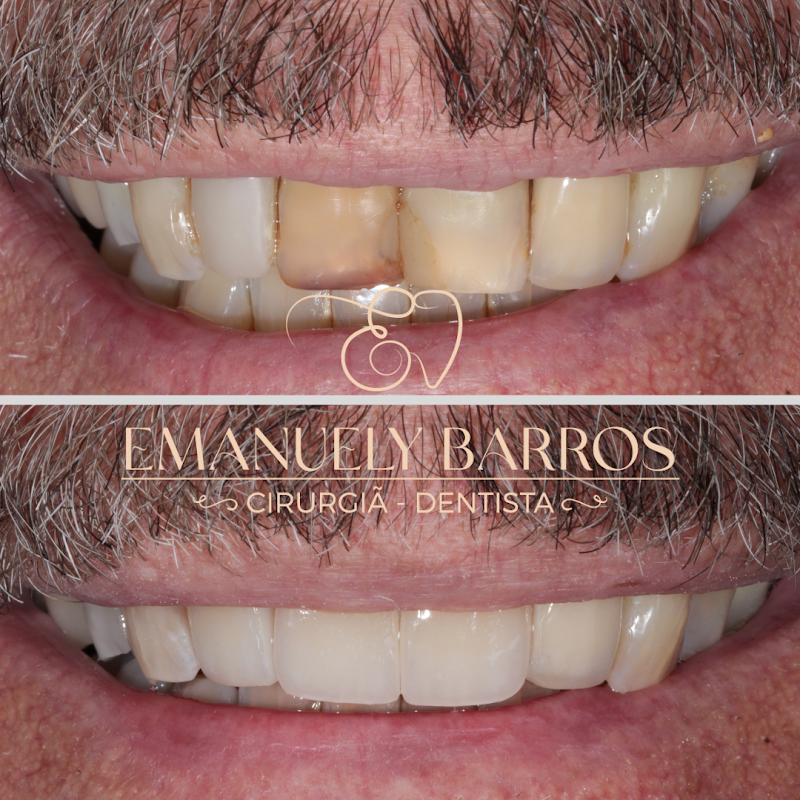 Dra Emanuely Barros - Dentista Campo Grande MS - foto 5