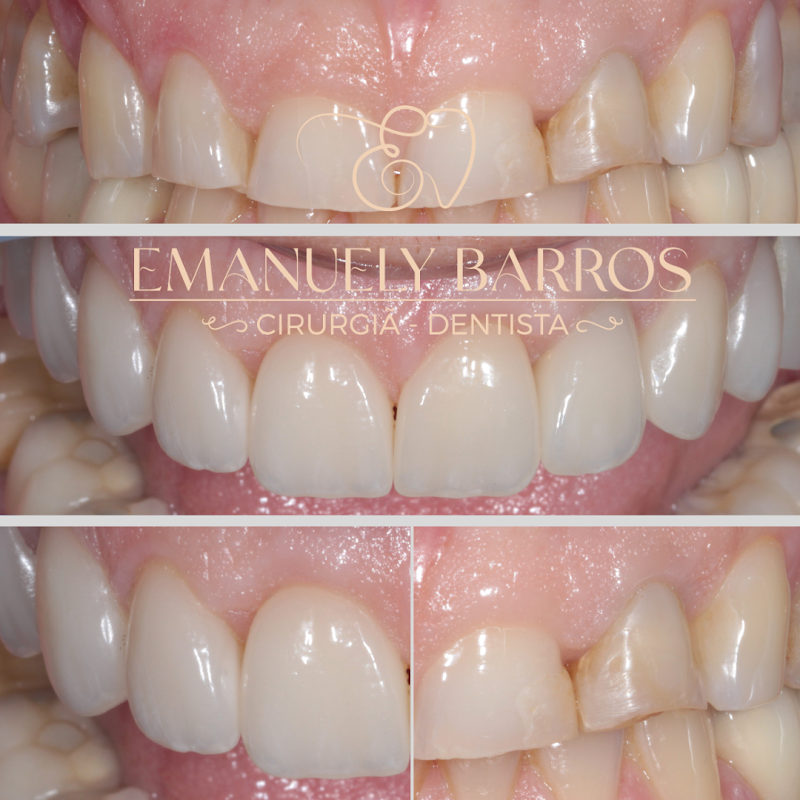 Dra Emanuely Barros - Dentista Campo Grande MS - foto 2