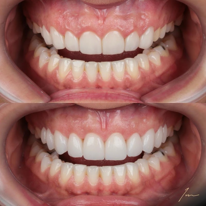 Implantec Odontologia