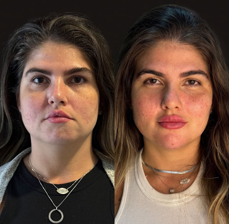 Dra. Ingrid Villar . Cirurgiã Dentista . Especialista em Harmonização Orofacial - foto 4