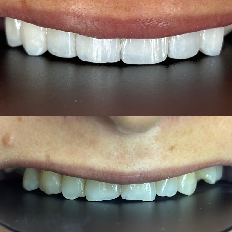 Clínica Odontológica Dra. Ruama Melo - Facetas em Resina, Aparelhos, Alinhadores, Implantes e Próteses | Dentista em Cuiabá - foto 3