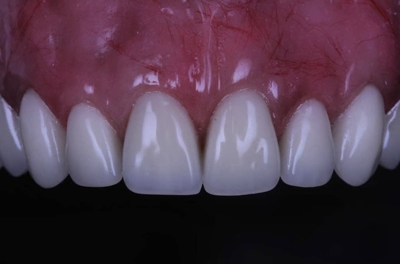 Dra Ana Claudia Monteiro | Dentista | Casa Forte Recife - foto 3