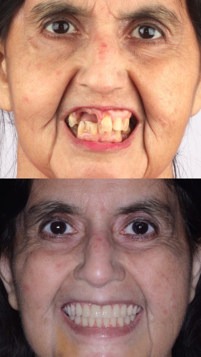 Dr. Thiago Maia Implantes - foto 4