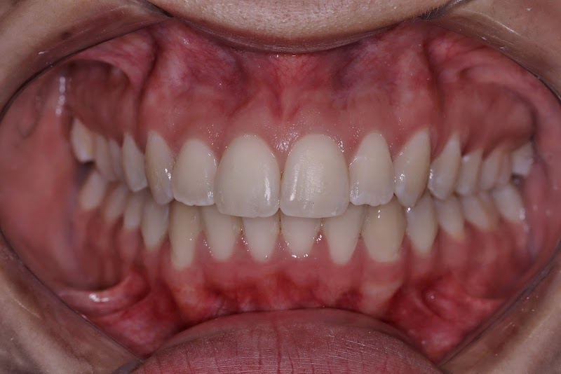 Dra Ingrid Andrei | Ortodontia | Dentista - foto 4