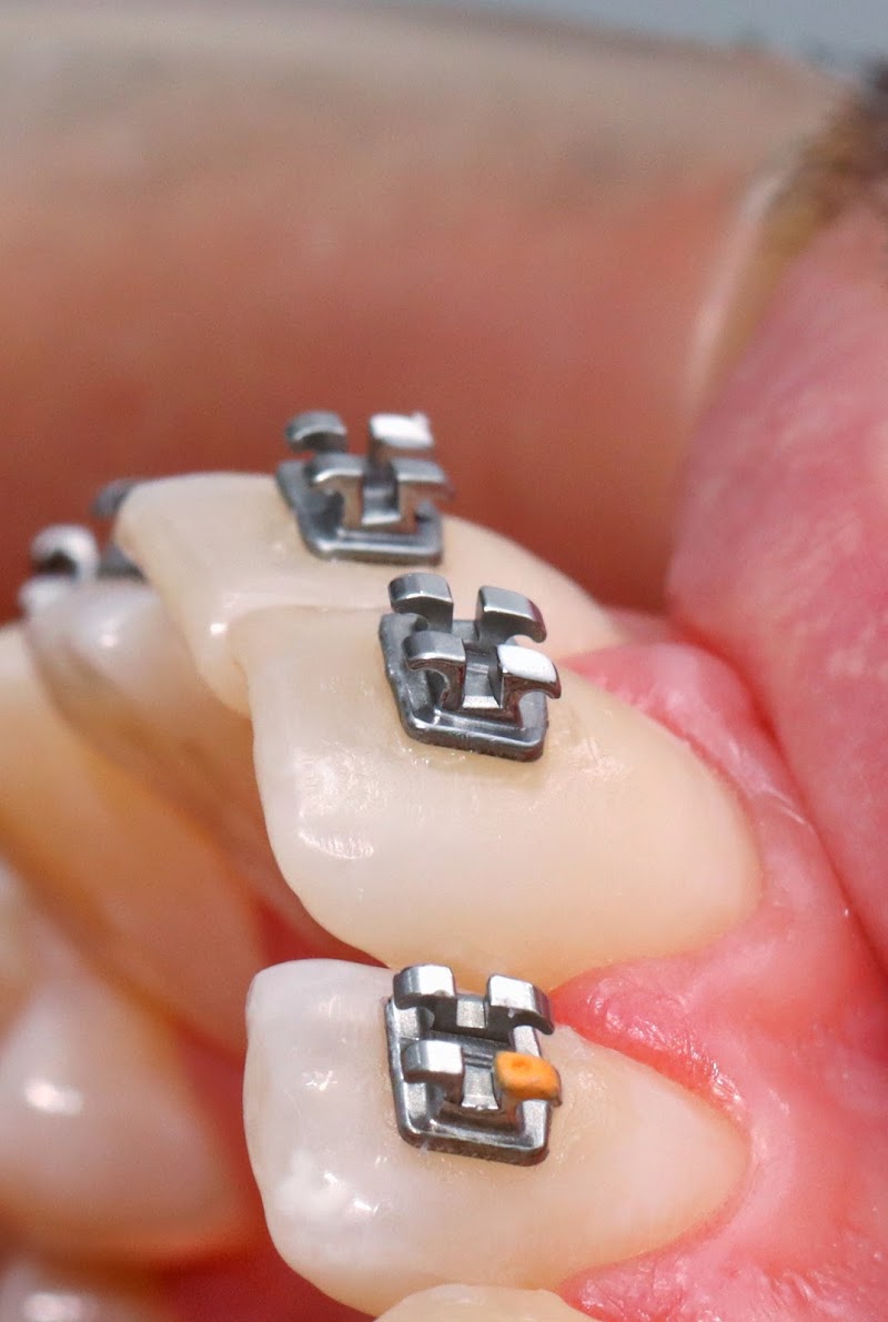 Dra Ingrid Andrei | Ortodontia | Dentista - foto 5