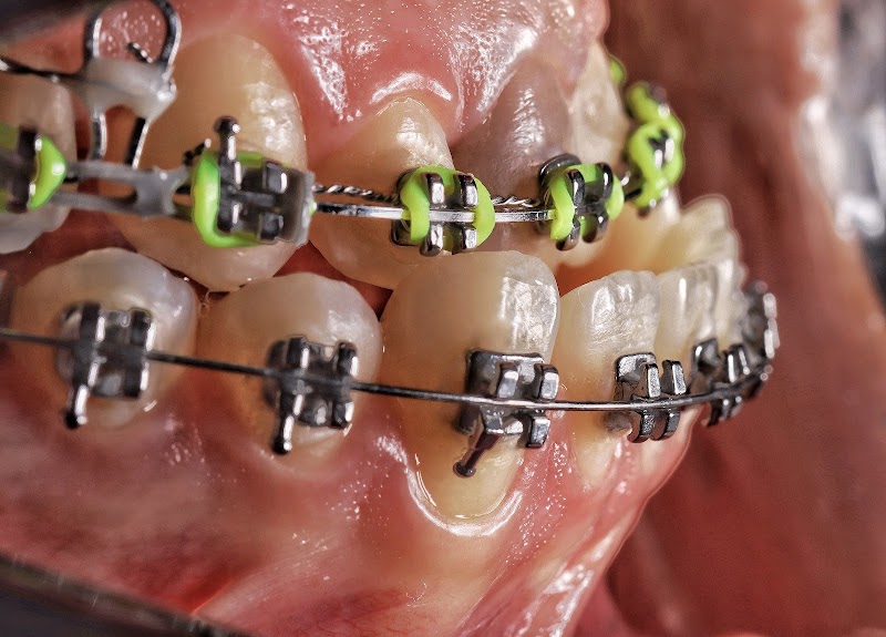 Dra Ingrid Andrei | Ortodontia | Dentista - foto 3