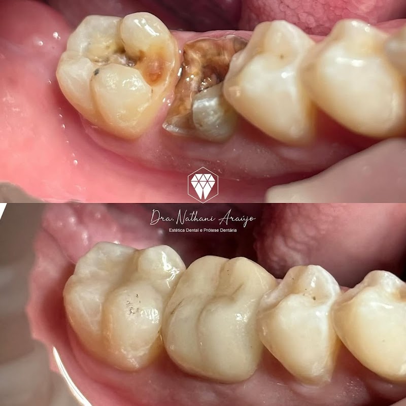 Dra Nathani Araújo | Dentista especialista em Odontologia Estética e Prótese dentária - foto 2