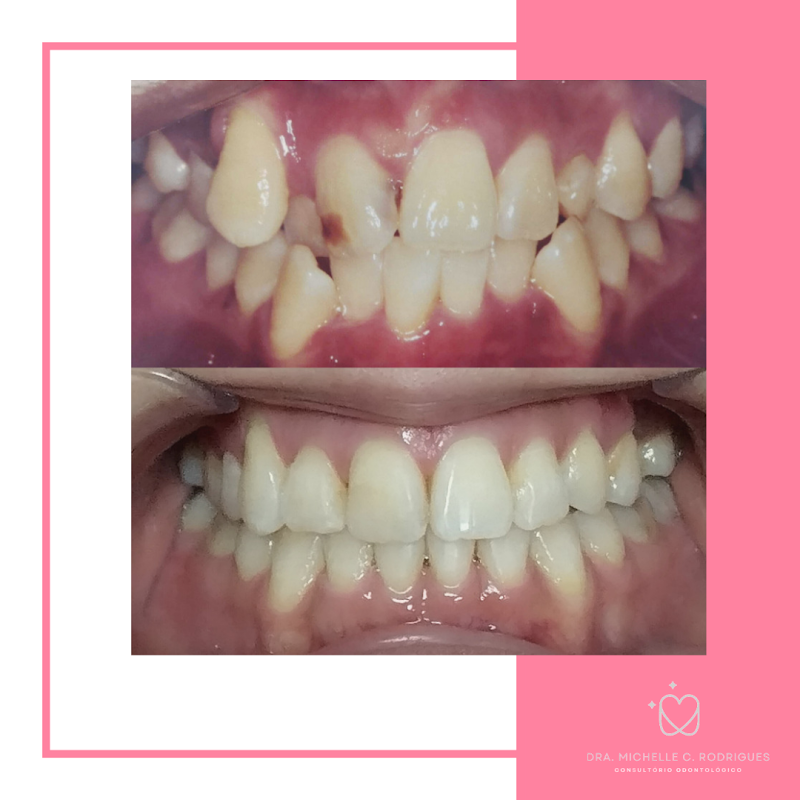 Dra. Michelle C. Rodrigues - Dentista - foto 5