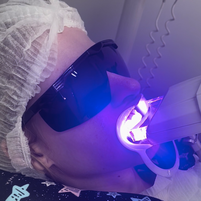 AMS Odontologia — Clareamento Dental com LED Violeta | Facetas de Porcelana em Campinas - foto 3