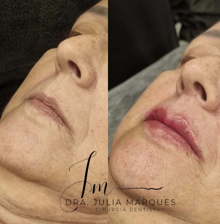 Dra. Julia Marques- Cirurgiã- Dentista | Estomatologista | Harmonização Orofacial l Clínico Geral