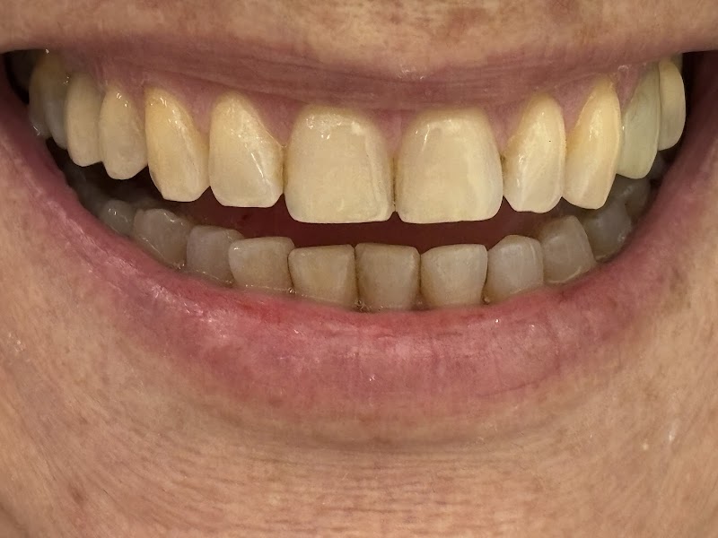 Dra Jaqueline Sousa / Clínica Odontológica no Catete - foto 5