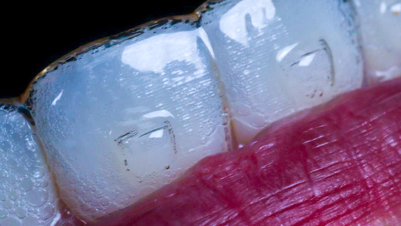 Dra. Bruna Gomes - ortodontista - Invisalign Doctor - foto 3