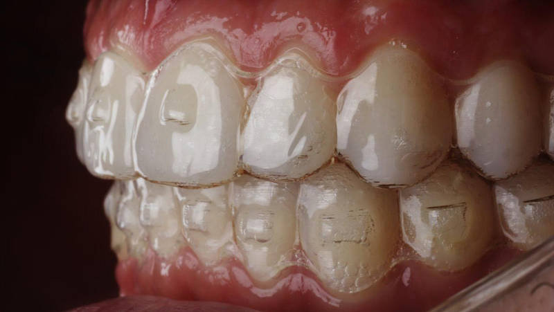 Dra. Bruna Gomes - ortodontista - Invisalign Doctor - foto 5