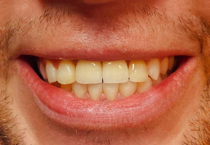 OdontoEasy | Dentista | Implante Dentário | Centro | Nova Friburgo - RJ - foto 3