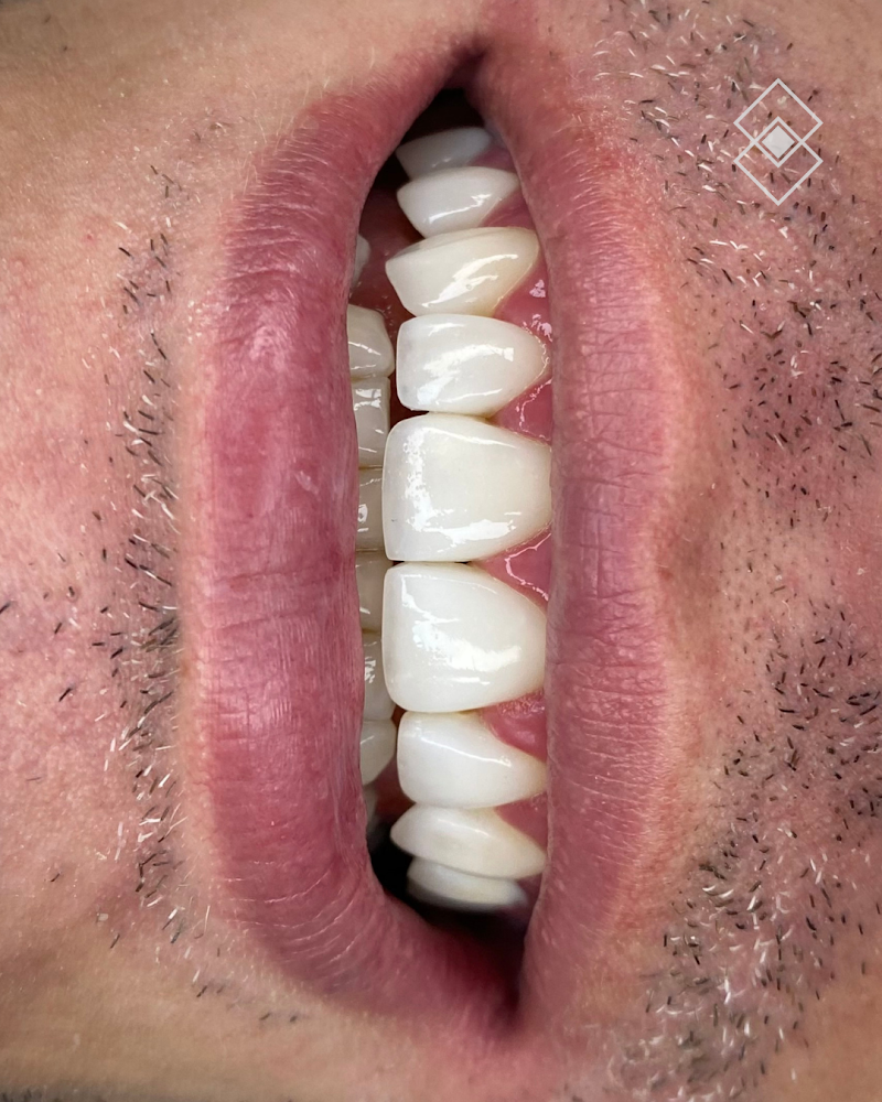 Dentista - Dra Mirian Pessoa - foto 2