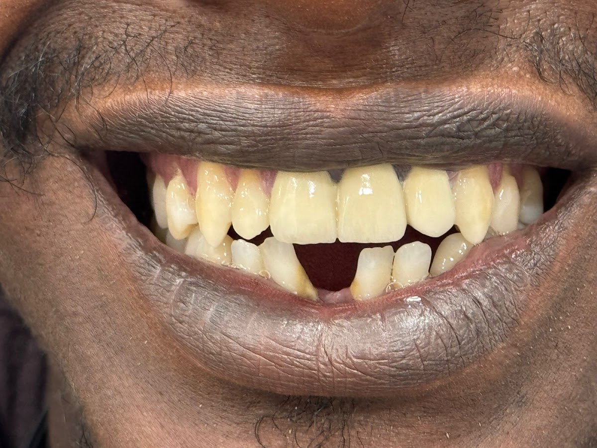 DREAM SMILE DENTAL CLINIC LLC - Best Dental Clinic | Teeth Whitening| Gold and Silver Teeth |Zirconia Bridges In Deira ,Dubai 5