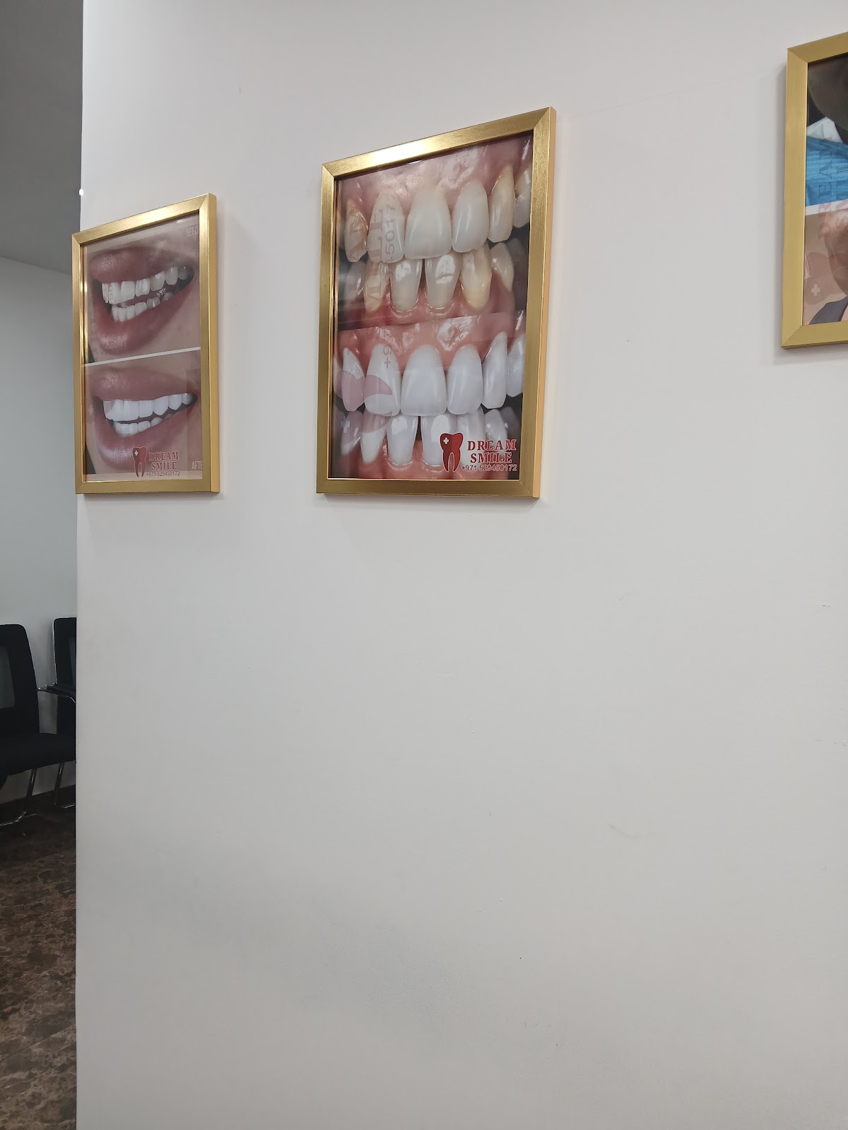 DREAM SMILE DENTAL CLINIC LLC - Best Dental Clinic | Teeth Whitening| Gold and Silver Teeth |Zirconia Bridges In Deira ,Dubai 4
