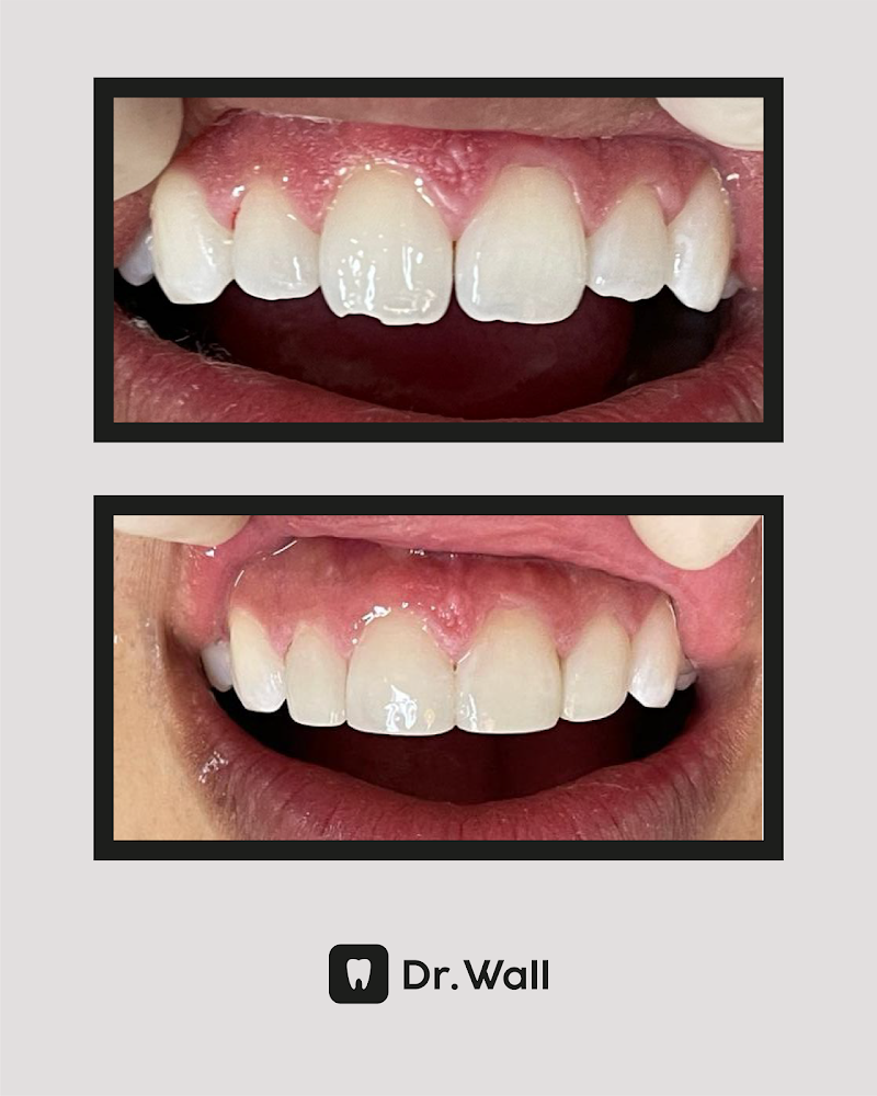 Dr. Wall - Dentista Moinhos de Vento - Rio Branco - Bom Fim - foto 4