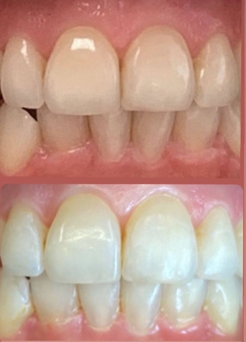 Natclin Odontologia - Clinica Odontológica Cuiabá - foto 5