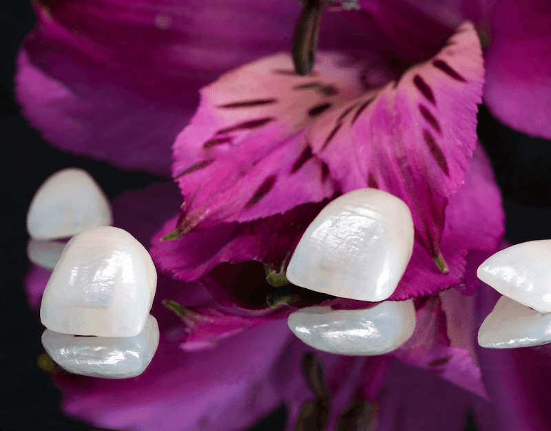 Dra Natalia Liuzzi - Lentes de Contato Dental e Facetas de Porcelana - Dental Tourism - Dental Veneers - Dentist for Expats - foto 3