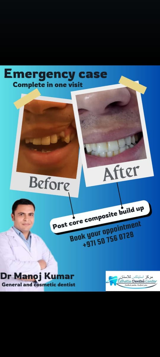 Dr Manoj Kumar - Dentist in Al Barsha 2