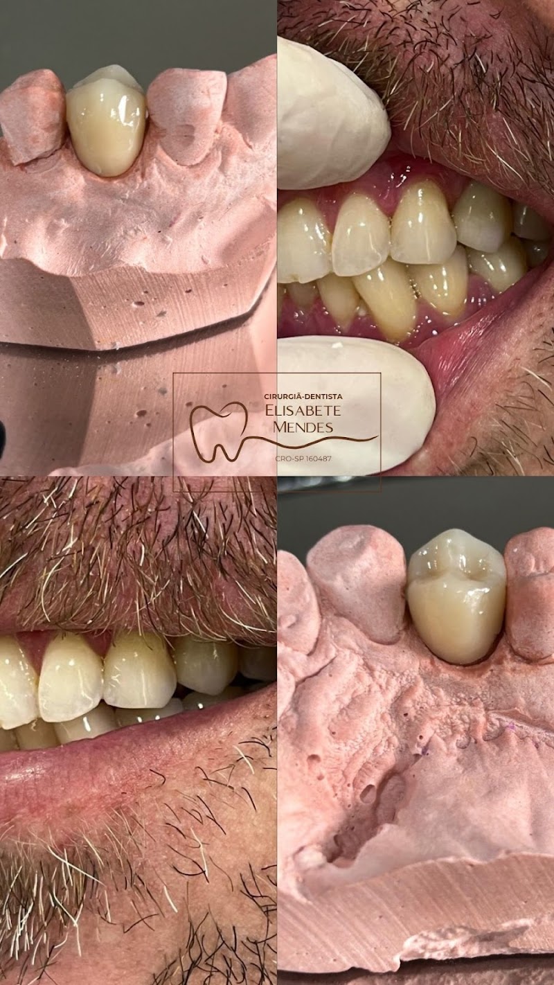 Dra. Elisabete Mendes - Dentista 24h Av. Paulista- Urgência e Prótese - foto 4