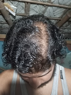 Dr. Neha kumari Agrawal (Skin, Hair, Nail Care Clinic and Dermatologist) - Image 3