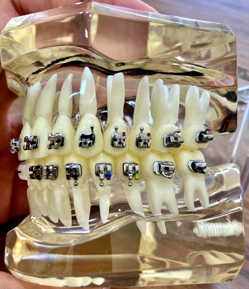 Dr. Rafael Siqueira - OrtoSiqueira - Ortodontia fixa/ Alinhadores INVISALIGN®/ Alinhadores SELF® - COPACABANA