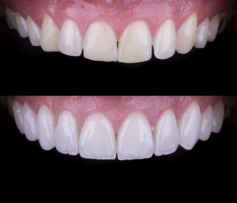 Dental Esthetic Center - foto 2