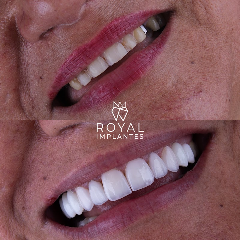 Royal Implantes - foto 3