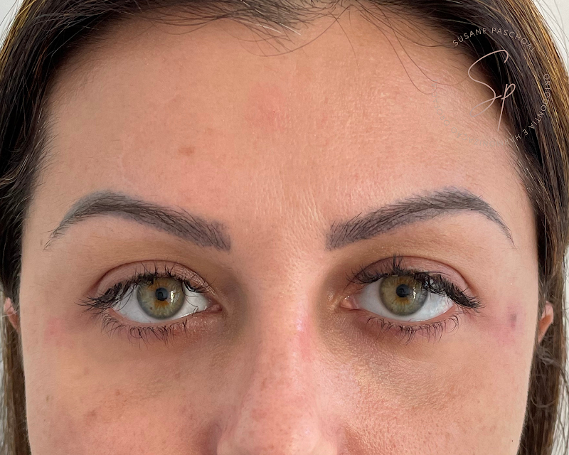 Dra. Susane Paschoal - Dentista Petrópolis, Harmonização Facial, Ortodontia, Clareamento Dental - foto 5