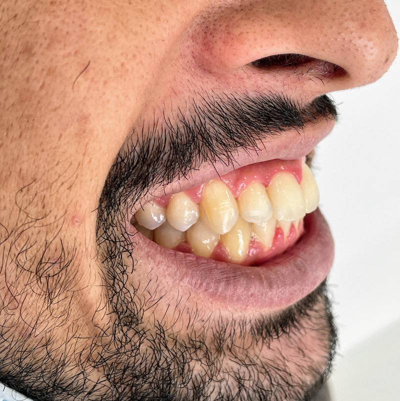 Dra. Susane Paschoal - Dentista Petrópolis, Harmonização Facial, Ortodontia, Clareamento Dental - foto 2